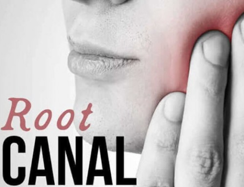 The Truth about Root Canals
