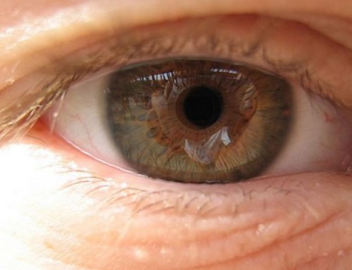 Macular Degeneration